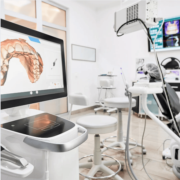 Implantes dentales